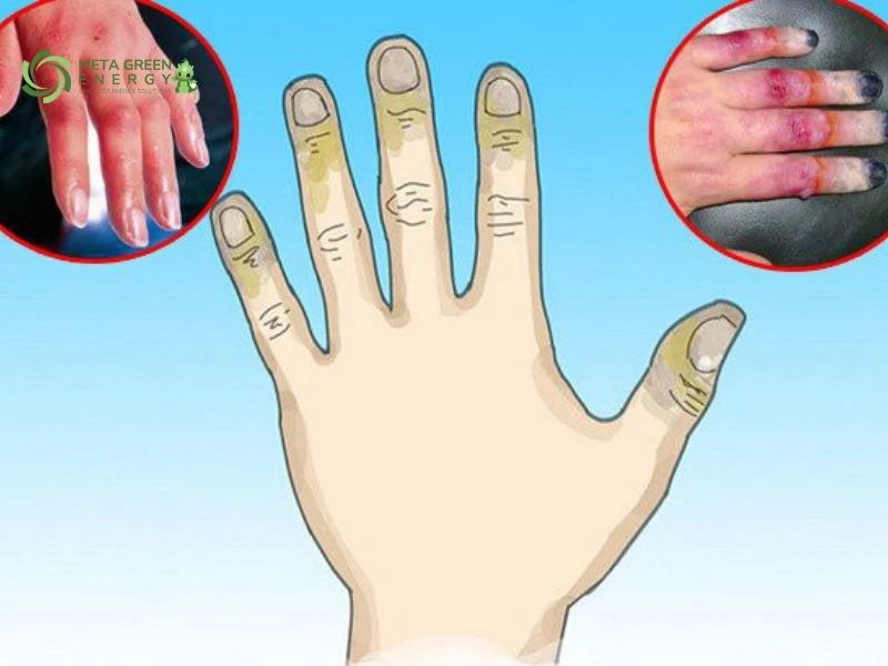 Các mối nguy tiềm ẩn khi sử dụng LNG